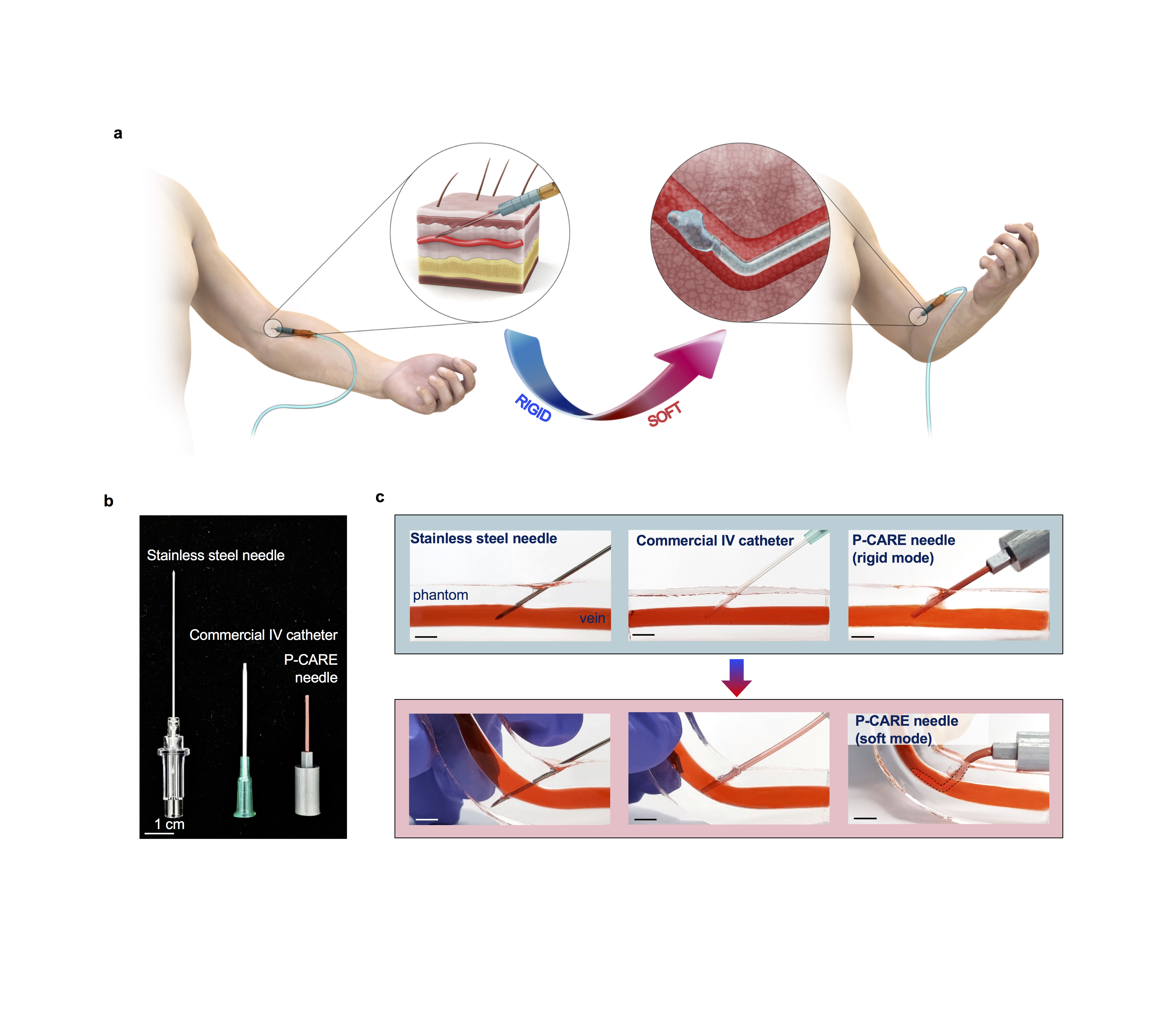 그림 1. 일회용 가변강성 정맥 주사바늘 (a) 체온에 의해 기계적 물성 변화가 가능한 일회용 정맥 주사바늘 활용에 대한 개념도, (b) 상용 정맥 주사바늘과 가변강성 정맥 주사바늘, (c) 상용 정맥 주사바늘과 가변강성 정맥 주사바늘의 생체조직 친화력 비교 Reprinted from Agno et al., 2023, Nature Biomedical Engineering. <Copyright nBME 2023 by Springer Nature