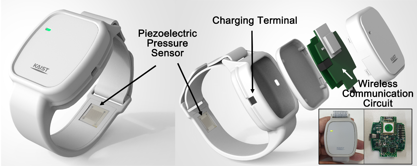 Figure 2.Wearable piezoelectric blood pressure sensor mounted on a watch (Figure 2 from Adv. Mater. 35(26), 2301627 (2023))